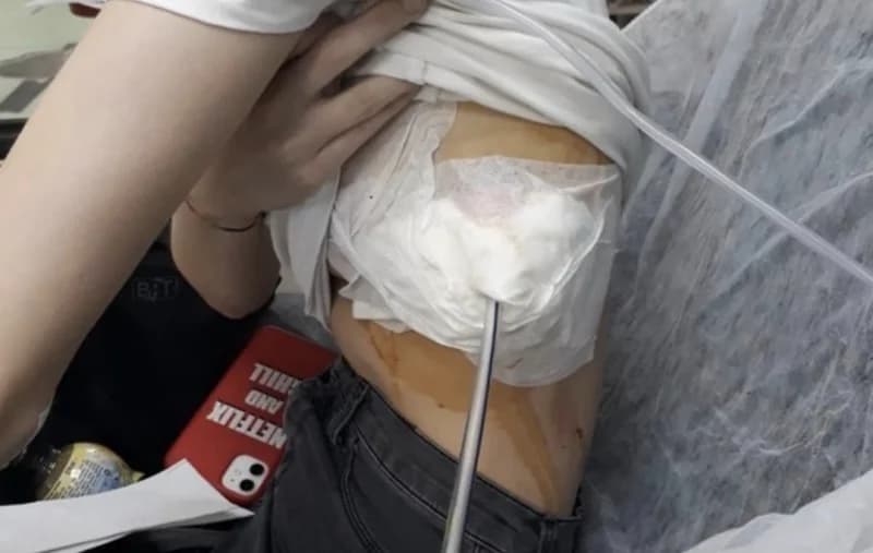 İzmir'de elektronik sigara alarmı!